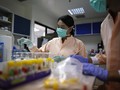 CDC Konfirmasi Hubungan Zika dan Mikrosefalus