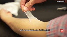 Ilmuwan Kembangkan Kulit Kedua untuk Tutupi Kerutan