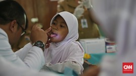 Virus HPV Bisa Menular Lewat Mulut dan Tangan