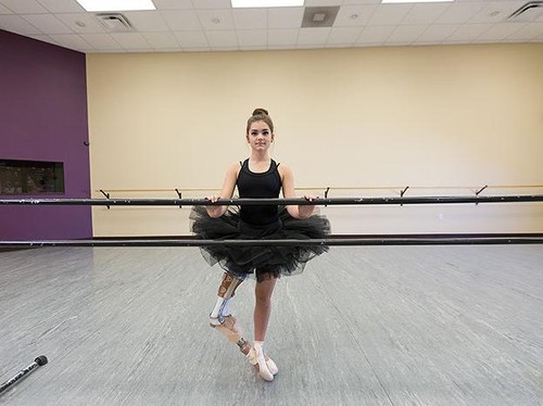 Kisah Balerina yang Tetap Bisa Menari Pasca Kaki Diamputasi karena Kanker Kisah Balerina yang Tetap Bisa Menari Pasca Kaki Diamputasi karena Kanker