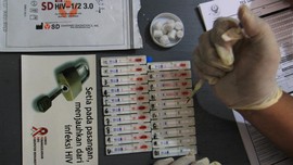Atasi HIV/AIDS, Klinik Pengobatan ARV Jangkau Masyarakat