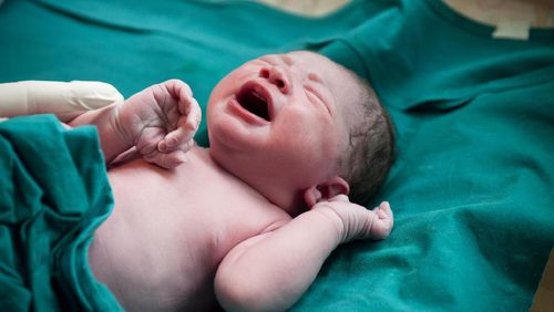 Fakta-fakta Lanugo yang Viral karena Mirip Duri di Punggung Bayi 1 Fakta-fakta Lanugo yang Viral karena Mirip Duri di Punggung Bayi 1