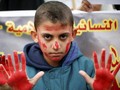 Israel Bakal Bantu Evakuasi Sipil di Aleppo