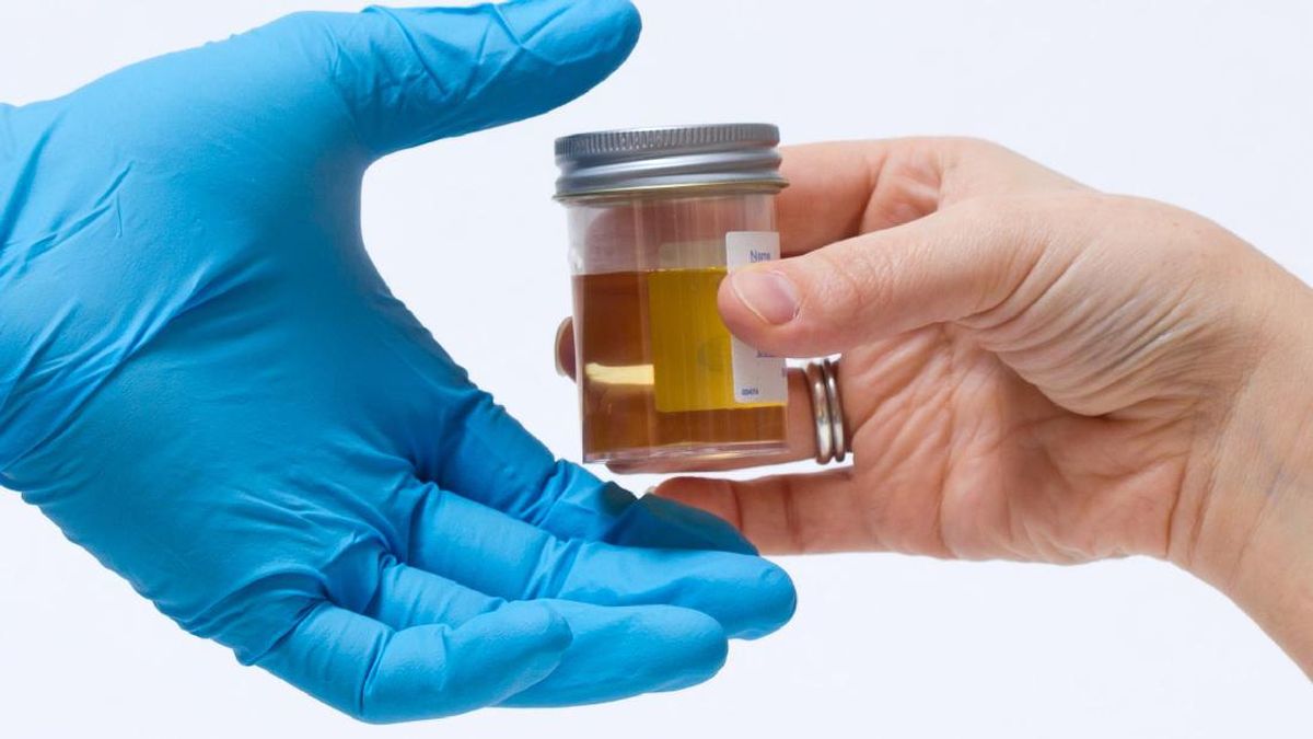 2 Kepling di Medan Terseret Narkoba, DPRD Minta Pemkot Lakukan Tes Urine
