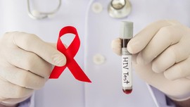 HIV Pada Hewan Percobaan Berhasil Dihentikan Tim Peneliti AS
