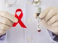 Cerita Ayu Oktariani Berjuang Menghadapi HIV AIDS