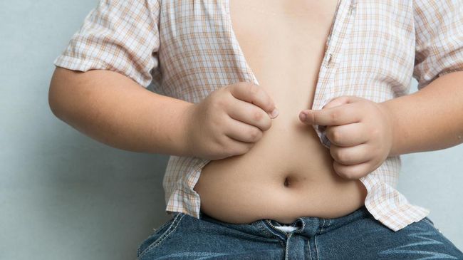 Semakin Banyak Orang Indonesia Alami Obesitas
