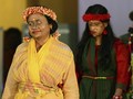 Kala Korban Siraman Air Keras Bergaya di Catwalk