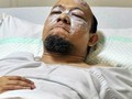 Operasi Mata Novel Baswedan Ditunda Dua Bulan