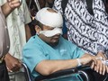 Novel Akan Jalani Operasi Mata Kedua
