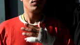 Lainnya, seorang imigran dari Aljazair menyebut luka di tangannya terjadi saat dia berusaha melompat ke kereta yang melaju kencang. Hingga kini dia masih di Thessaloniki, menyembuhkan diri, sebelum kembali berusaha menumpang kereta.