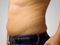 Seniman Sulap Stretch Mark dan Menstruasi Jadi Karya Seni