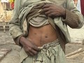 Praktik Perdagangan Organ Ilegal Marak di Pakistan