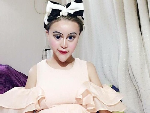 Wanita Ini Ngaku Paling Cantik Sedunia Usai Operasi Plastik, Setuju? Wanita Ini Ngaku Paling Cantik Sedunia Usai Operasi Plastik, Setuju?