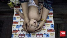 Bayi Baru Lahir Wajib Daftar Peserta BPJS Dalam 28 Hari