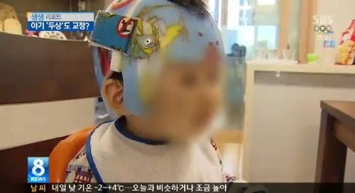 Ibu-ibu Korea Pakaikan Helm pada Bayi Agar Bentuk Wajah Anak Lebih Cantik Ibu-ibu Korea Pakaikan Helm pada Bayi Agar Bentuk Wajah Anak Lebih Cantik