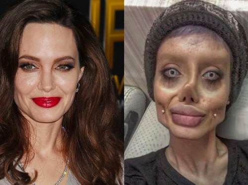 Wanita Iran 50 Kali Operasi Plastik demi Mirip Jolie, Tapi Hasilnya... Wanita Iran 50 Kali Operasi Plastik demi Mirip Jolie, Tapi Hasilnya...