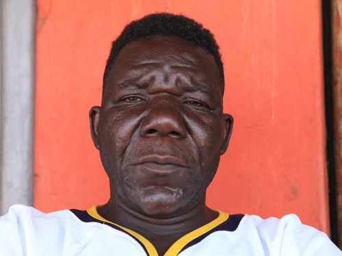 William Masvinu, Pria Terjelek yang Menangkan Kontes Zimbabwe Mr Ugly 2017 William Masvinu, Pria Terjelek yang Menangkan Kontes Zimbabwe Mr Ugly 2017