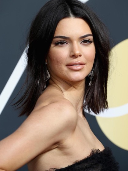 Kendall Jenner Juga Manusia, Wajah Banyak Jerawat Saat Tampil di Red Carpet Kendall Jenner Juga Manusia, Wajah Banyak Jerawat Saat Tampil di Red Carpet
