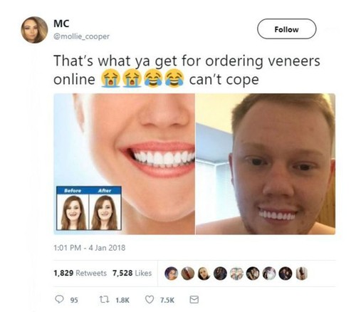 Niat Punya Gigi Rapi dengan Veneer Instan, Pria Ini Malah Terlihat Konyol Niat Punya Gigi Rapi dengan Veneer Instan, Pria Ini Malah Terlihat Konyol