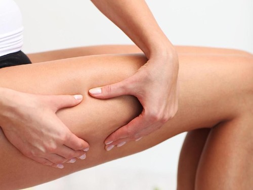 Cara Hilangkan Stretch Marks dalam 2 Minggu Ini Jadi Viral, Mau Coba? Cara Hilangkan Stretch Marks dalam 2 Minggu Ini Jadi Viral, Mau Coba?