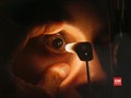VIDEO: Kali Pertama, Wanita Oregon Terinfeksi Cacing Parasit