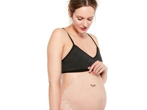 Bye Stretch Marks! Kini Ada Masker untuk Perut Hamil Bye Stretch Marks! Kini Ada Masker untuk Perut Hamil