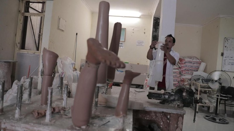 Yayasan tersebut memproduksi tangan dan kaki palsu untuk penyandang tuna daksa.