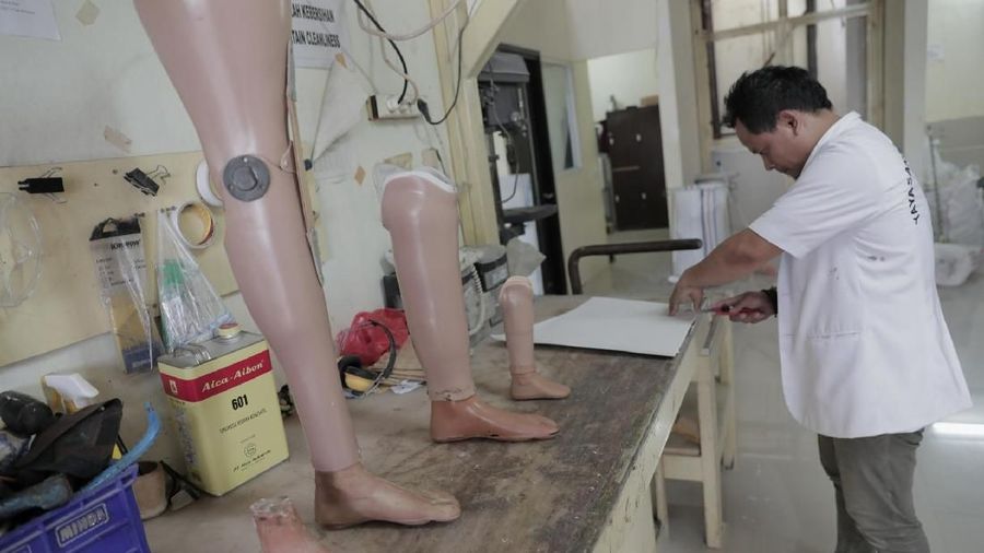 Pembuatan Kaki Palsu
