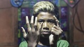 Ganjar, 13, menderita penyakit kulit karena menggunakan air Sungai Citarum yang sudah terkontaminasi limbah pabrik untuk mandi sehari-hari di Desa Sukamaju, Majalaya, Jawa Barat. (Anadolu Agency/Eko Siswono)