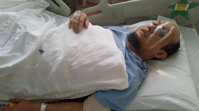 KPK Sebut Mata Kiri Novel Membaik Usai Operasi Tahap Dua