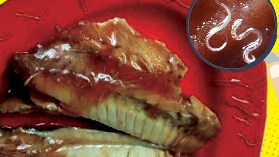 BPOM menemukan kandungan cacing laut parasit anisakis sp pada ikan makarel kaleng yang dijual dipasaran.