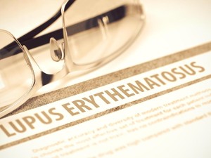 Apa Itu Penyakit Lupus? Kenali Gejala, Jenis, dan Cara Penanganannya