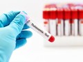Darurat Penyebaran Thalassemia di Indonesia