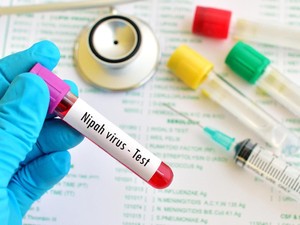 Kemenkes Pastikan Belum Ada Kasus Virus Nipah di RI, Imbau Warga Tetap Waspada