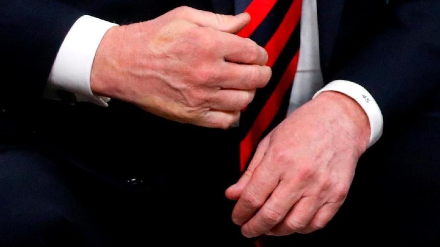Dalam upaya untuk membangun kembali industri Amerika, Trump telah memberlakukan tarif tinggi untuk impor baja dan aluminium, termasuk dari sekutu utama G7-nya.