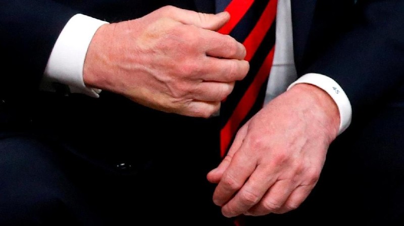 Dalam upaya untuk membangun kembali industri Amerika, Trump telah memberlakukan tarif tinggi untuk impor baja dan aluminium, termasuk dari sekutu utama G7-nya.