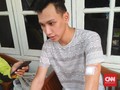 Kesaksian Korban Lemparan Batu dari Atas JPO Jalan Tol Tamer