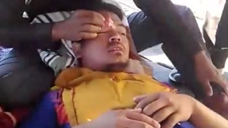 Gempa 6,4 SR yang mengguncang NTB menimbulkan korban jiwa.