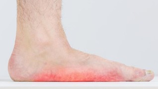 'Menebak' Penyakit dari Warna Kuku Jari Kaki