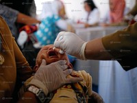 Kenali Gejala Enterovirus, Virus Mematikan 'Penyerang' Bayi