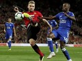 Bek Man United Luke Shaw Hampir Kehilangan Kaki Kanan