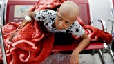 Tempat tidur di pusat medis itu pun sangat terbatas. Jumlah kasur hanya dapat untuk menampung pasien anak, sementara orang dewasa harus duduk di kursi ruang tunggu. (Reuters/Khaled Abdullah)