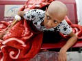 FOTO: Perang Yaman Lawan Kanker