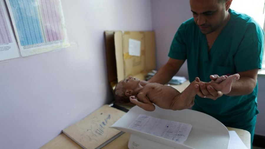 Diperkirakan 1,8 juta anak-anak kekurangan gizi di negara ini akibat konflik dalam tiga tahun ini.