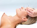 Mengenal Penggunaan Jarum pada Prosedur Facial