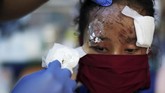 Seorang pasien korban gempa dan tsunami Sulteng sedang dibuka perbannya untuk diganti yang baru oleh seorang tenaga medis di sebuah rumah sakit Kota Palu, 4 Oktober 2018. (REUTERS/Athit Perawongmetha)