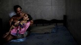 Gabriela Alves de Avezedo (22), misalnya. Dia tinggal bersama sang buah hati, Ana Sophia (3), yang mengidap mikrosefalus. Selain mengalamai gangguan tumbuh kembang, Ana juga bermasalah dalam penglihatan dan pendengaran. (REUTERS/Ueslei Marcelino)