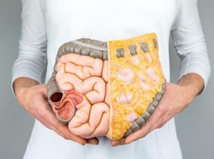 Kok Bisa Usia 20-an Sudah Kena Kanker Usus Besar? Dokter Bilang Gini