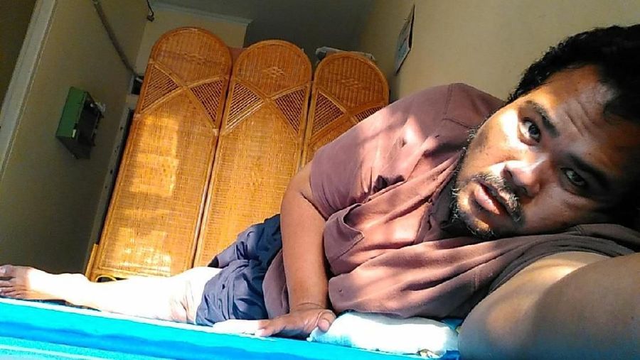 Foto Fahmi Bo saat stroke.